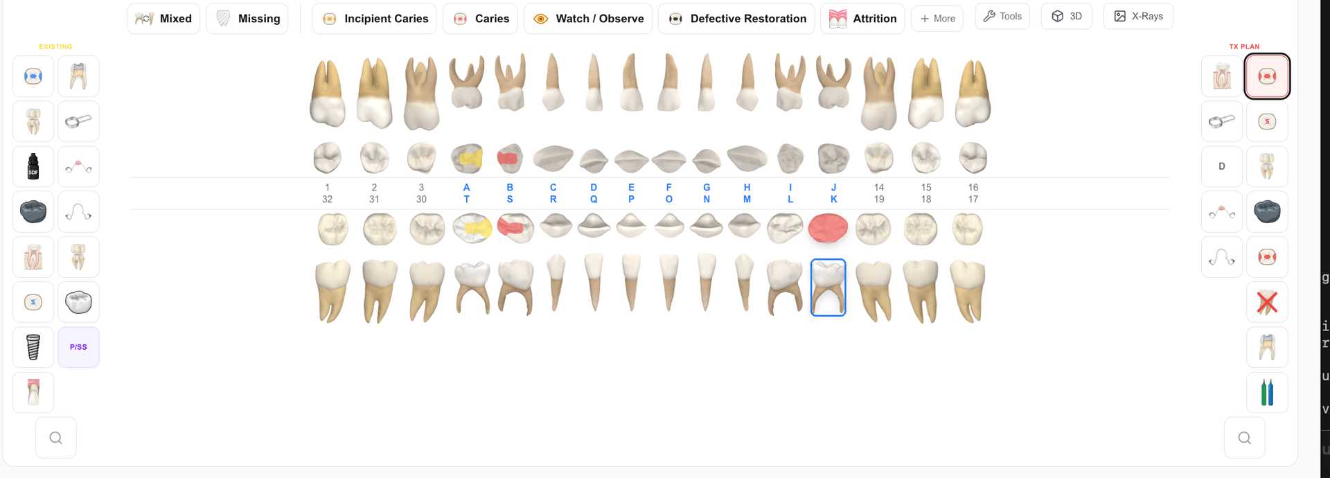 Ayla charting illustrations — photorealistic dental restorations and conditions
